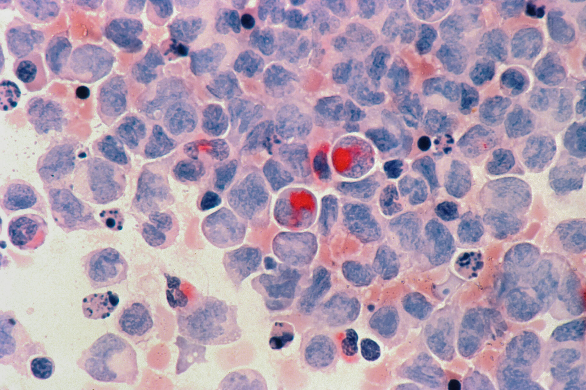Foto: National Cancer Institute/Unsplash
